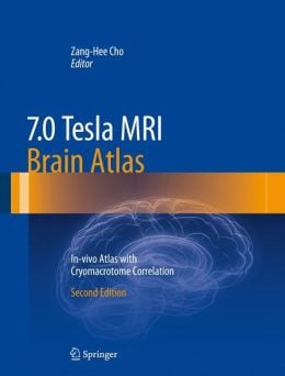 7.0 Tesla MRI Brain Atlas: In-vivo Atlas with Cryomacrotome Correlation