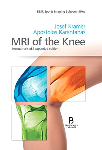 MRI of the Knee: Second revised & expanded edition