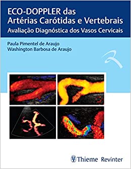 ECO-DOPPLER das Artérias Carótidas e Vertebrais: Avaliação Diagnóstica dos Vasos Cervicais