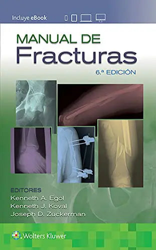 Manual de fracturas, 6ºEd