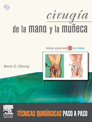 Cirugía de la mano y la muñeca