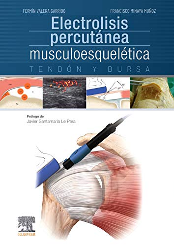 Electrolisis percutánea musculoesquelética. Tendón y bursa (Spanish Edition)