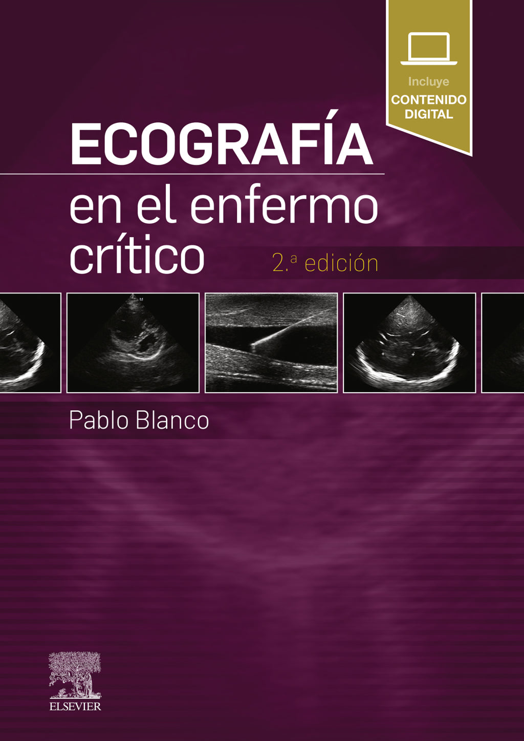 Ecografía en el enfermo crítico , 2nd Edition