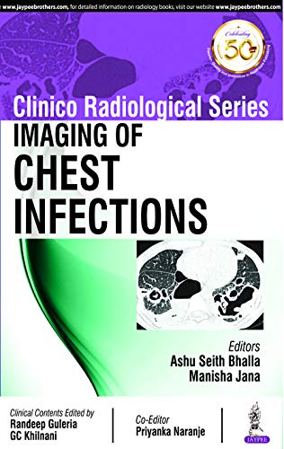 Imaging of Chest Infections (Clinico Radiological)