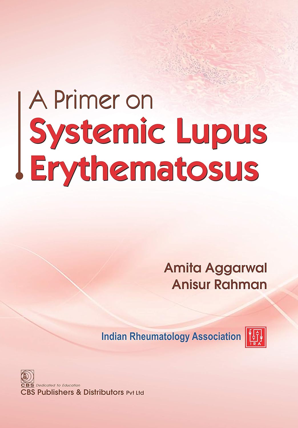 A Primer on Lupus Systematic Erythematosus