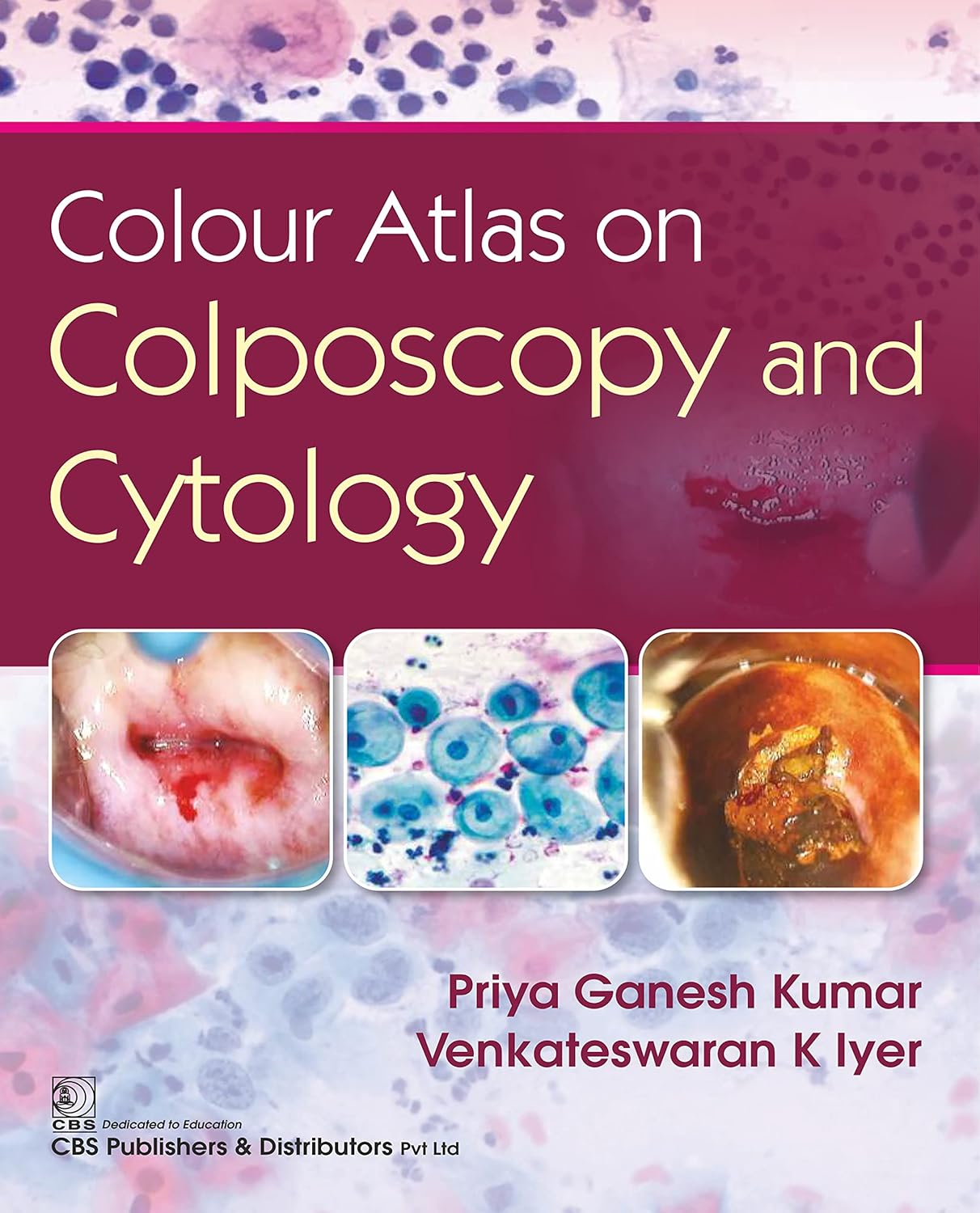 Colour Atlas on Colposcpoy and Cytology
