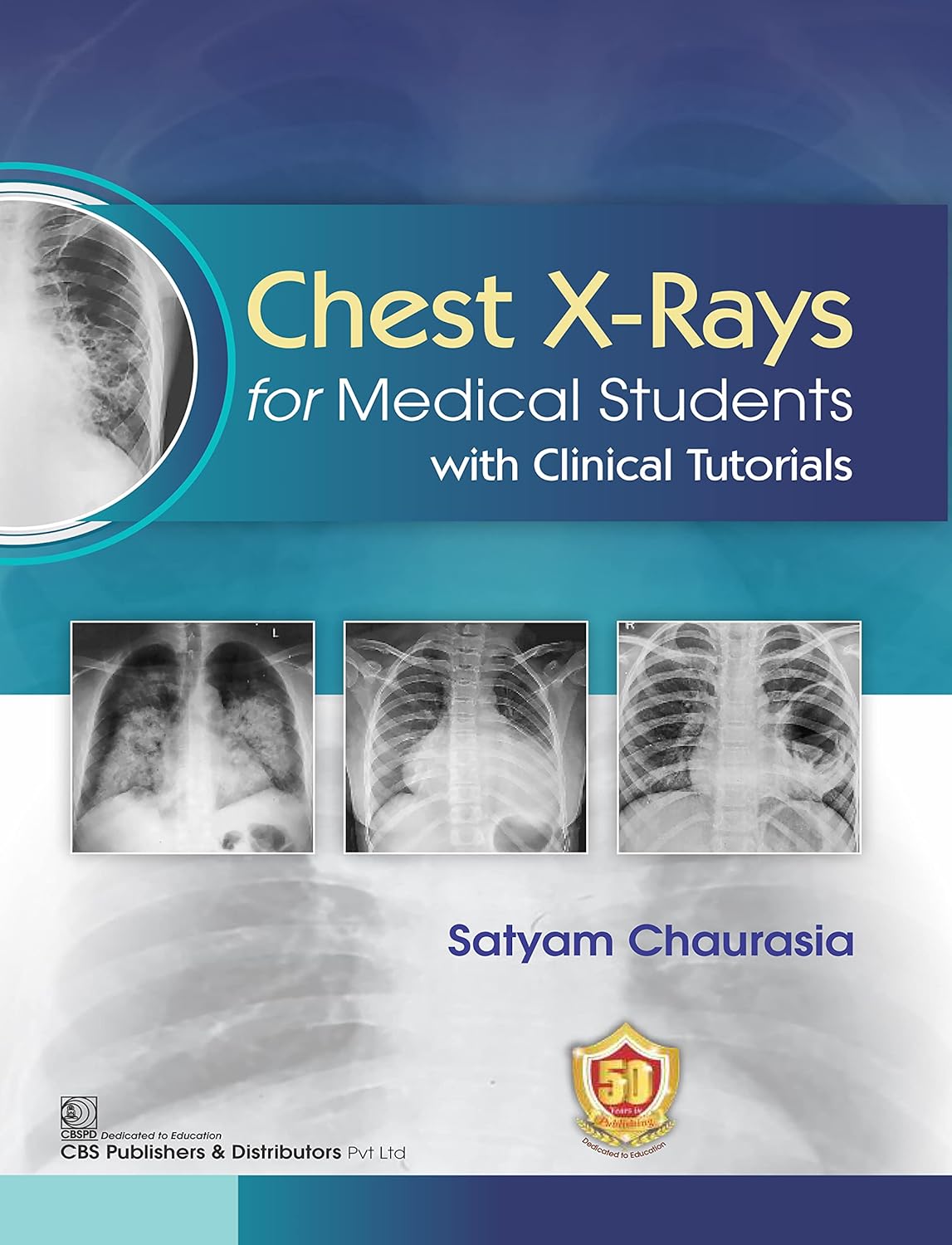 Chest X-ray for Medical Students with Clinical Tutorials