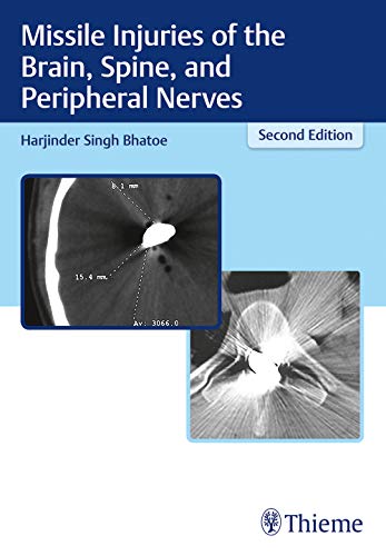 Missile Injuries Of The Brain Spine And Peripheral Nerves, 2nd edition