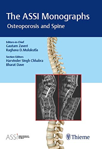 The ASSI Monographs – Osteoporosis and Spine