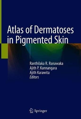 Atlas of Dermatoses in Pigmented Skin