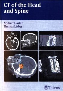CT of the Head and Spine