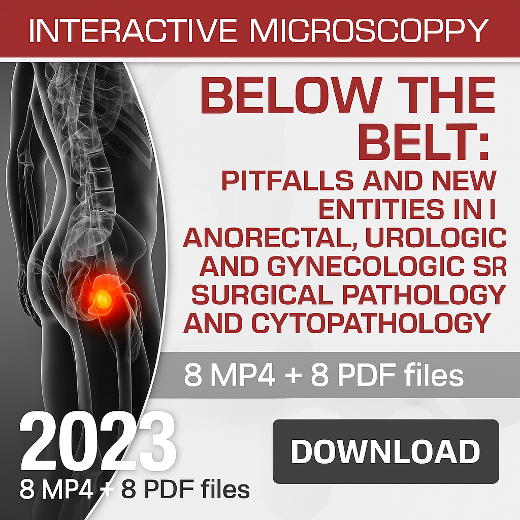 USCAP BELOW THE BELT: Pitfalls and New Entities in Anorectal, Urologic and Gynecologic Surgical Pathology and Cytopathology 2023 (Videos)