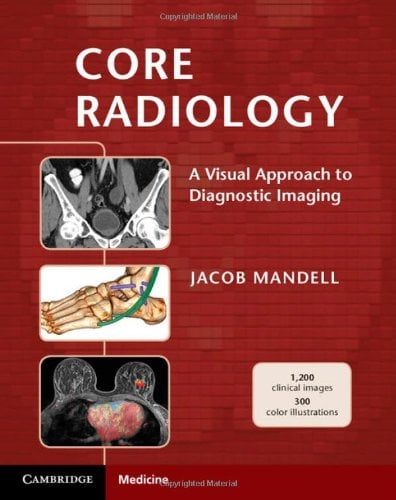 Core Radiology: A Visual Approach to Diagnostic Imaging
