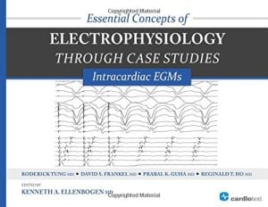 Essential Concepts of Electrophysiology through Case Studies: Intracardiac EGMs (ORIGINAL PDF from Publisher)
