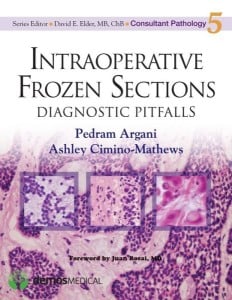 Intraoperative Frozen Sections: Diagnostic Pitfalls (Consultant Pathology)