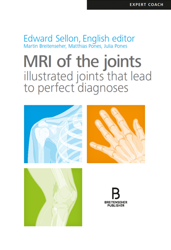 MRI of the Joints