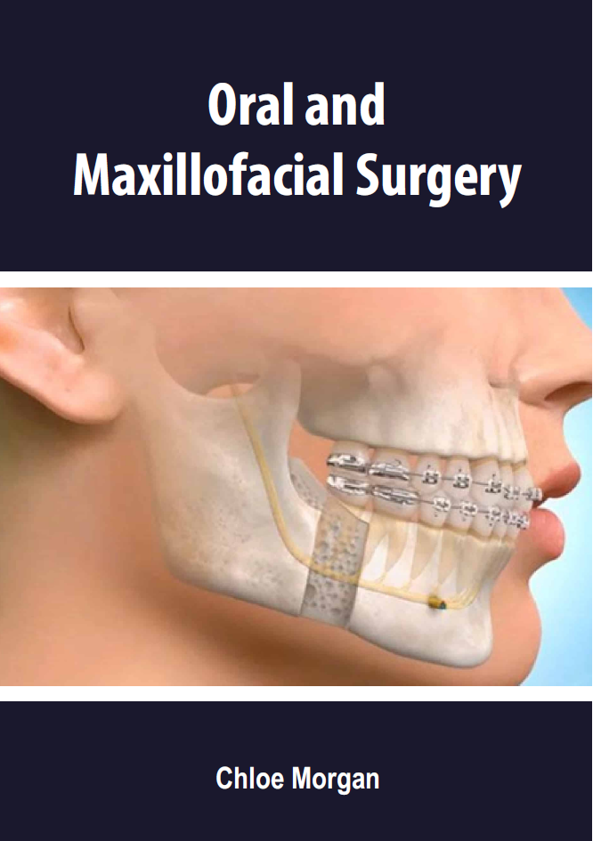 Oral and Maxillofacial Surgery