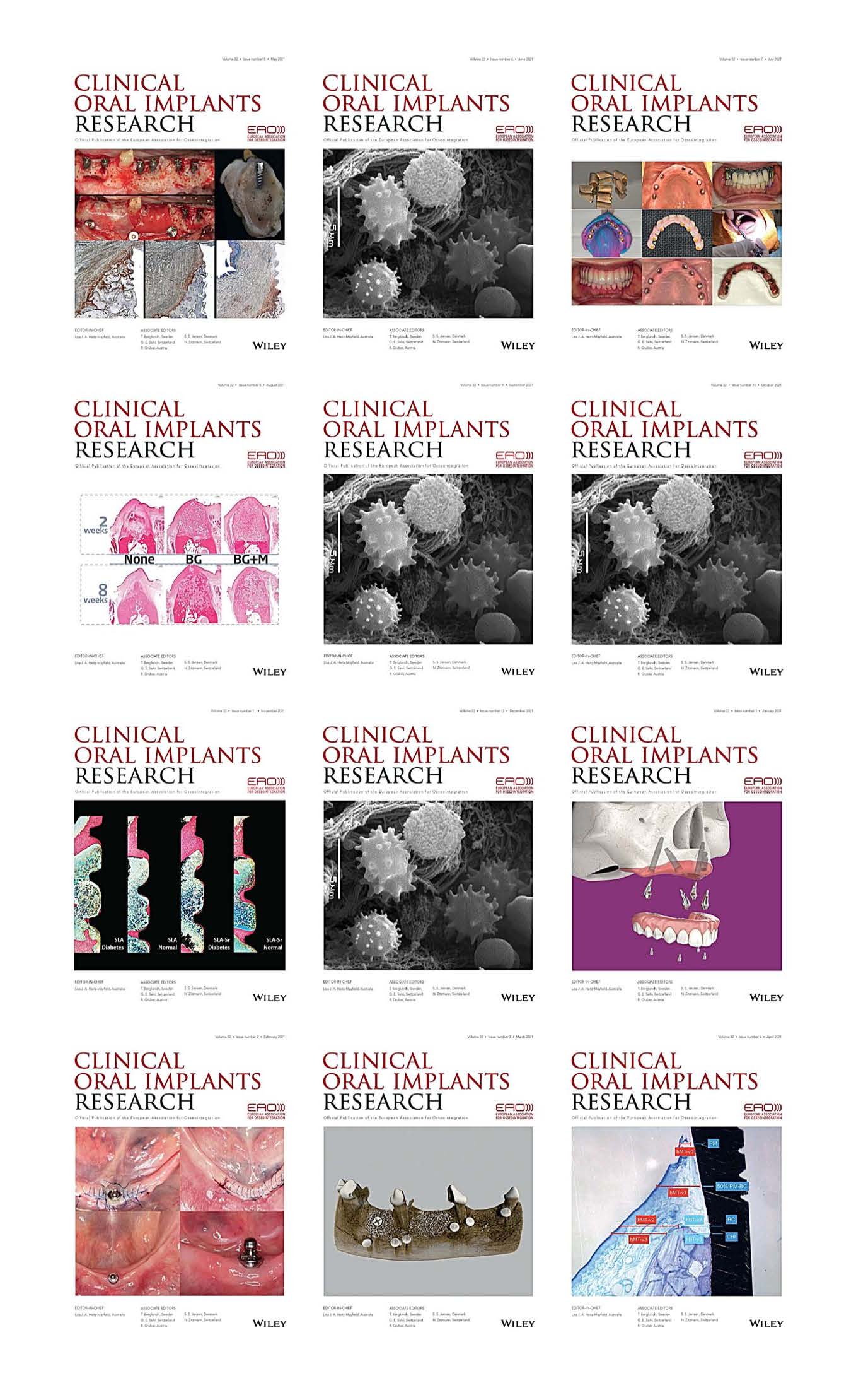 Clinical Oral Implants Research 2021 Full Archives