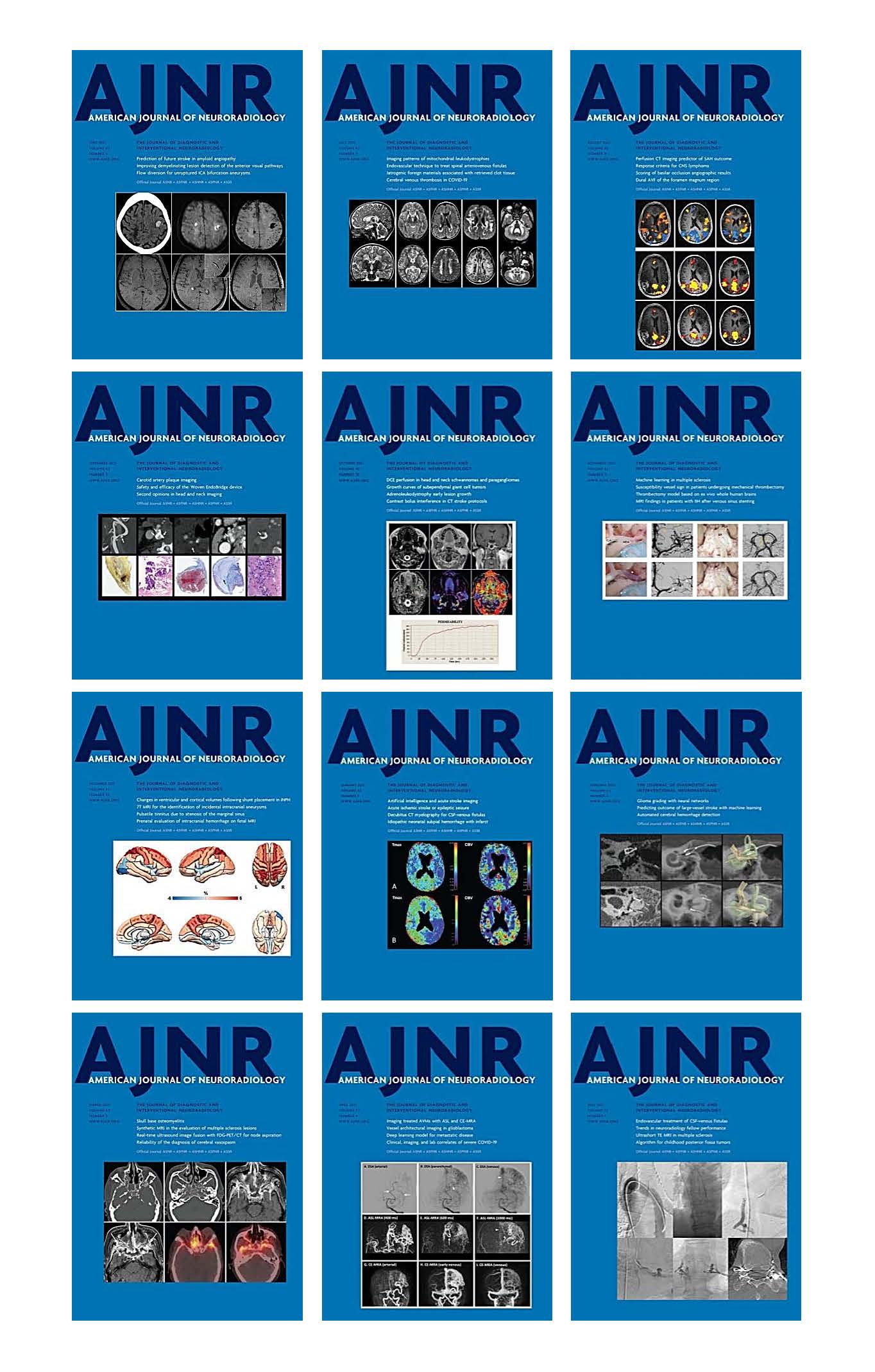 American journal of Neuroradiology 2021 Full Archives (True PDF)