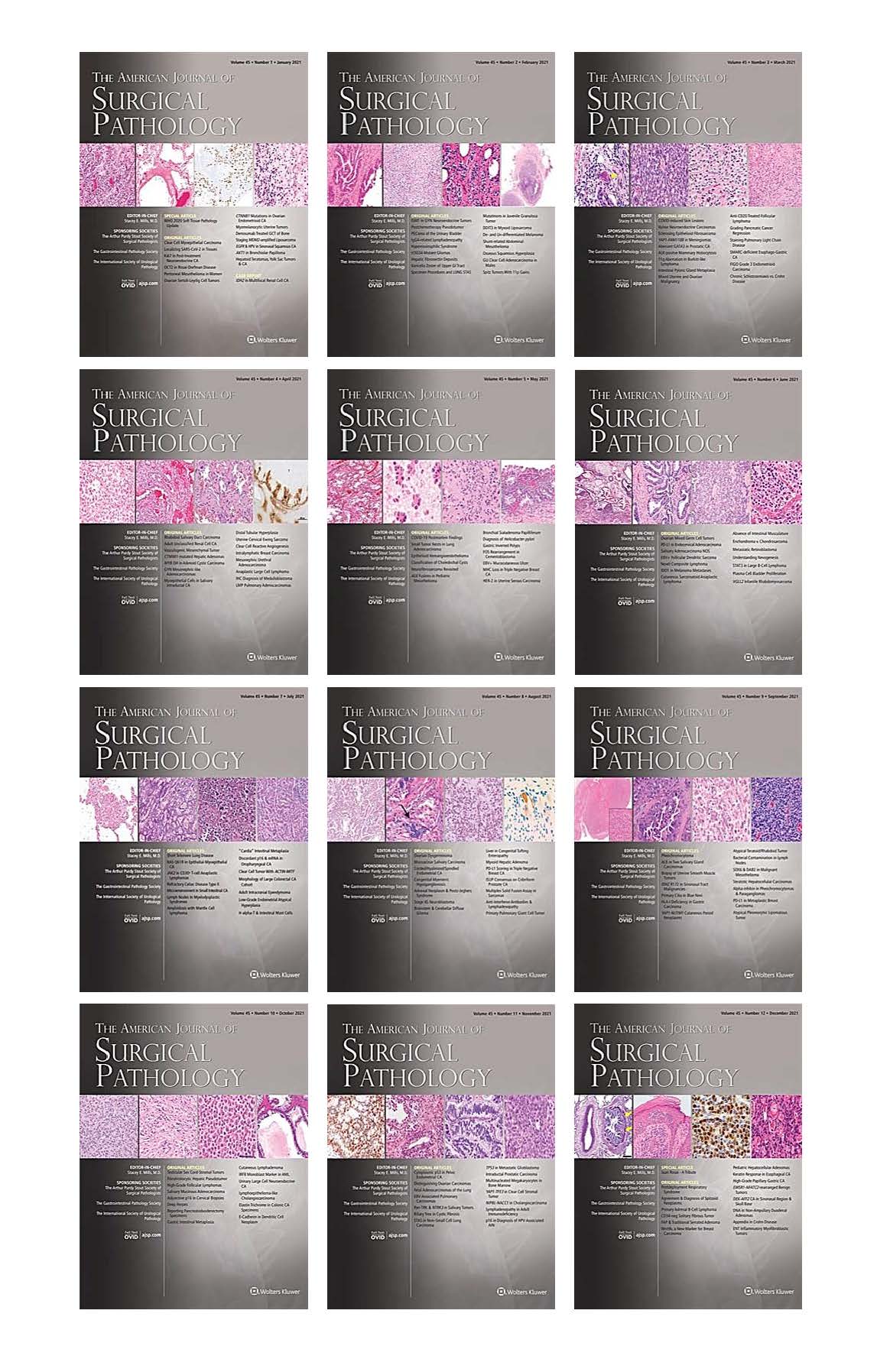 American Journal of Surgical Pathology 2021 Full Archives (True PDF)