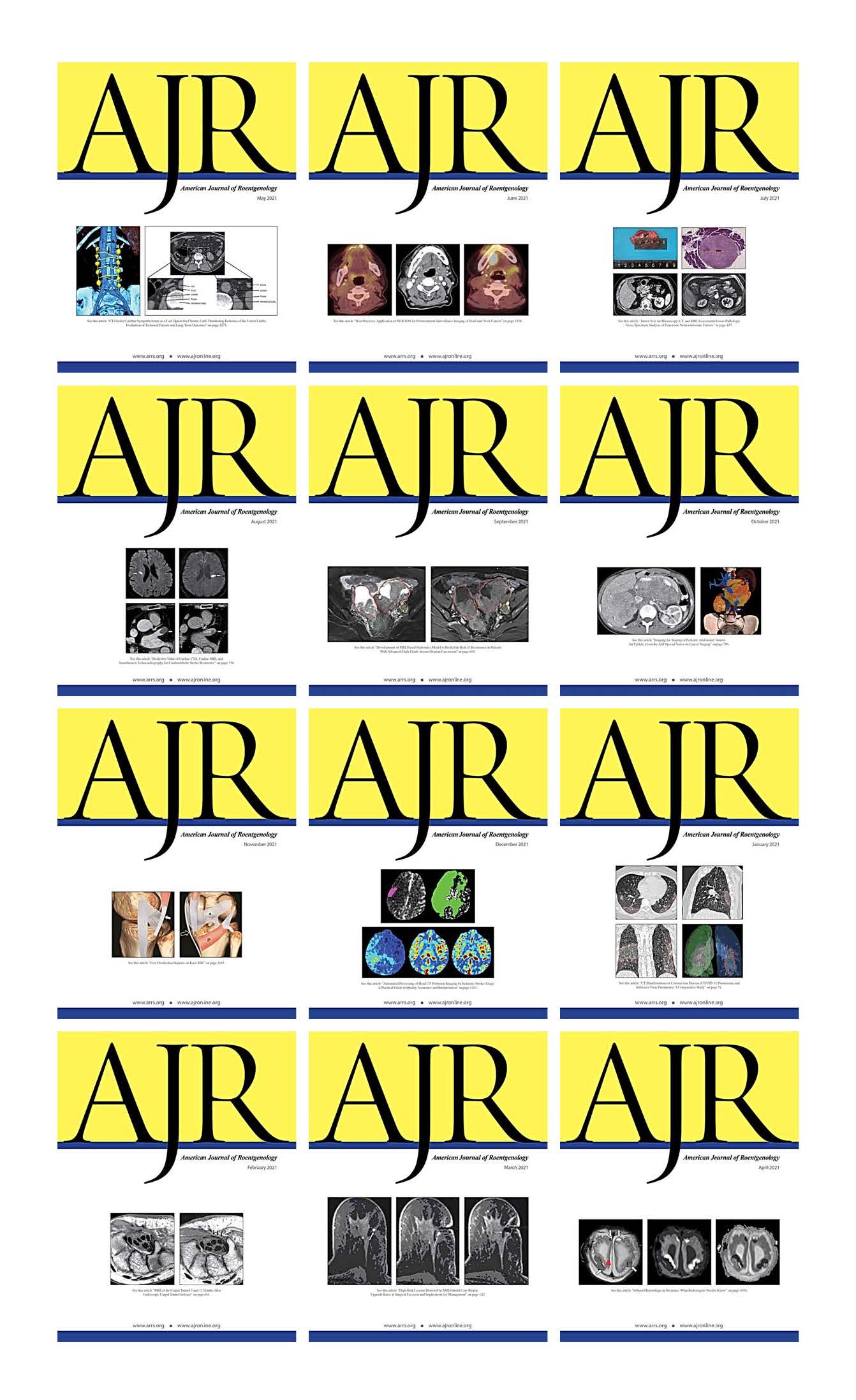 American Journal of Roentogelogy 2021 Full Archives (True PDF)