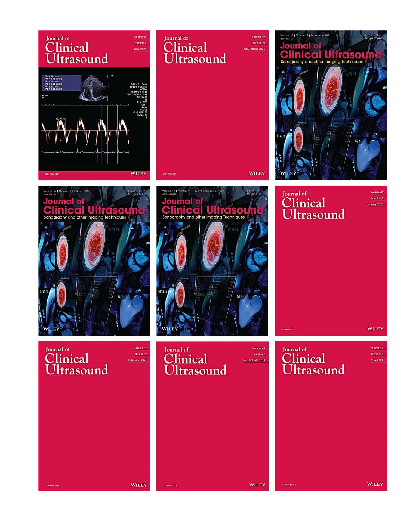 Journal of Clinical Ultrasound 2021 Full Archives (True PDF)