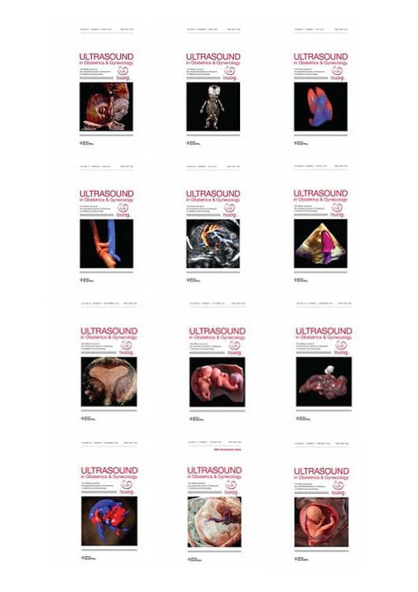 Ultrasound in Obstetrics & Gynecology 2021 Full Archives (True PDF)