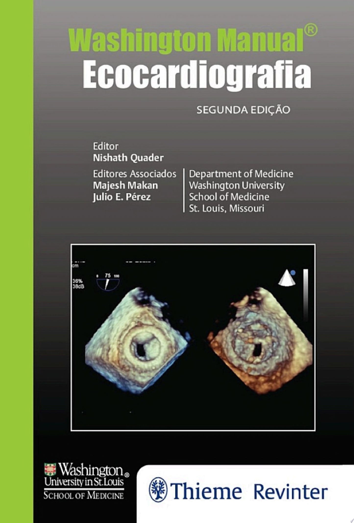 Washington. Manual Ecocardiografia, 2nd Edition