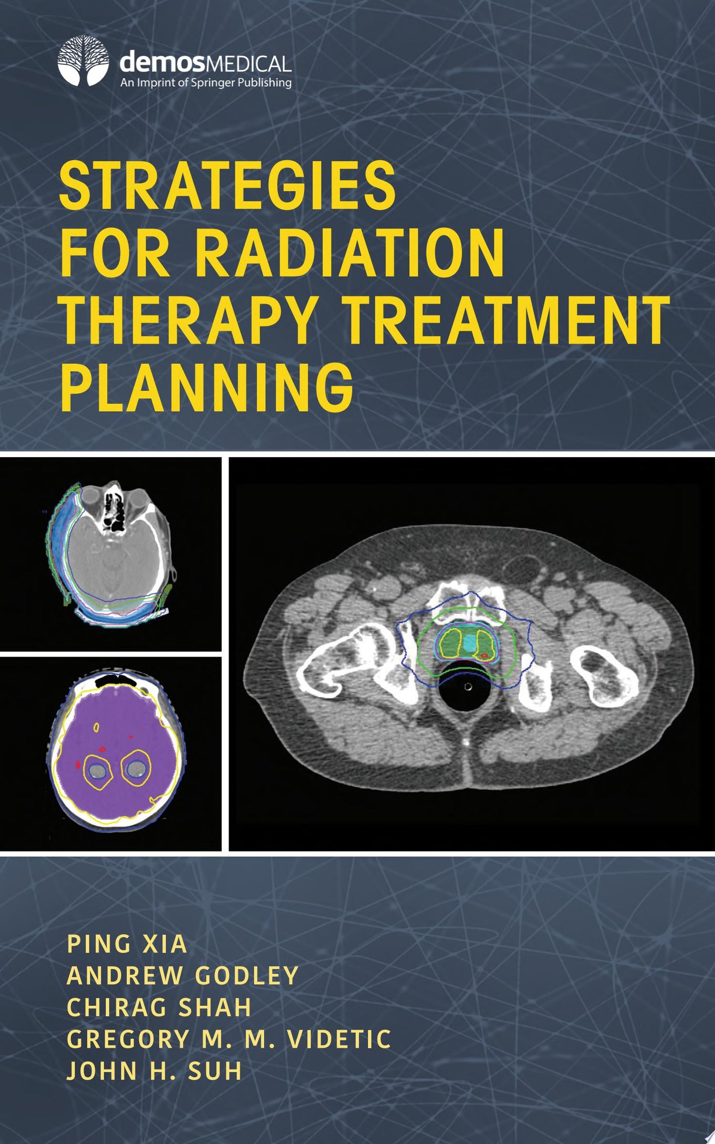 Strategies for Radiation Therapy Treatment Planning