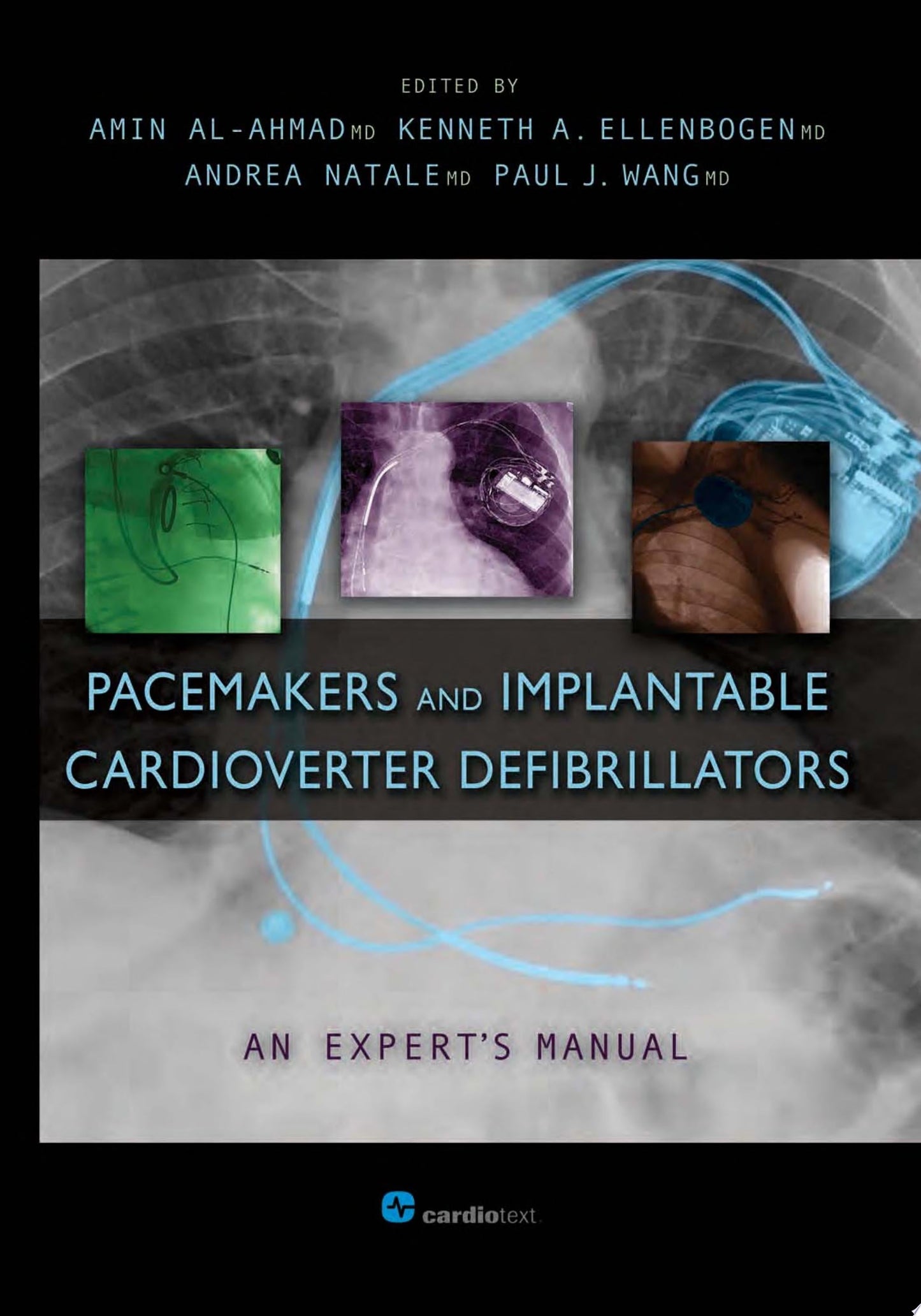 Pacemakers and Implantable Cardioverter Defibrillators: An Expert’s Manual