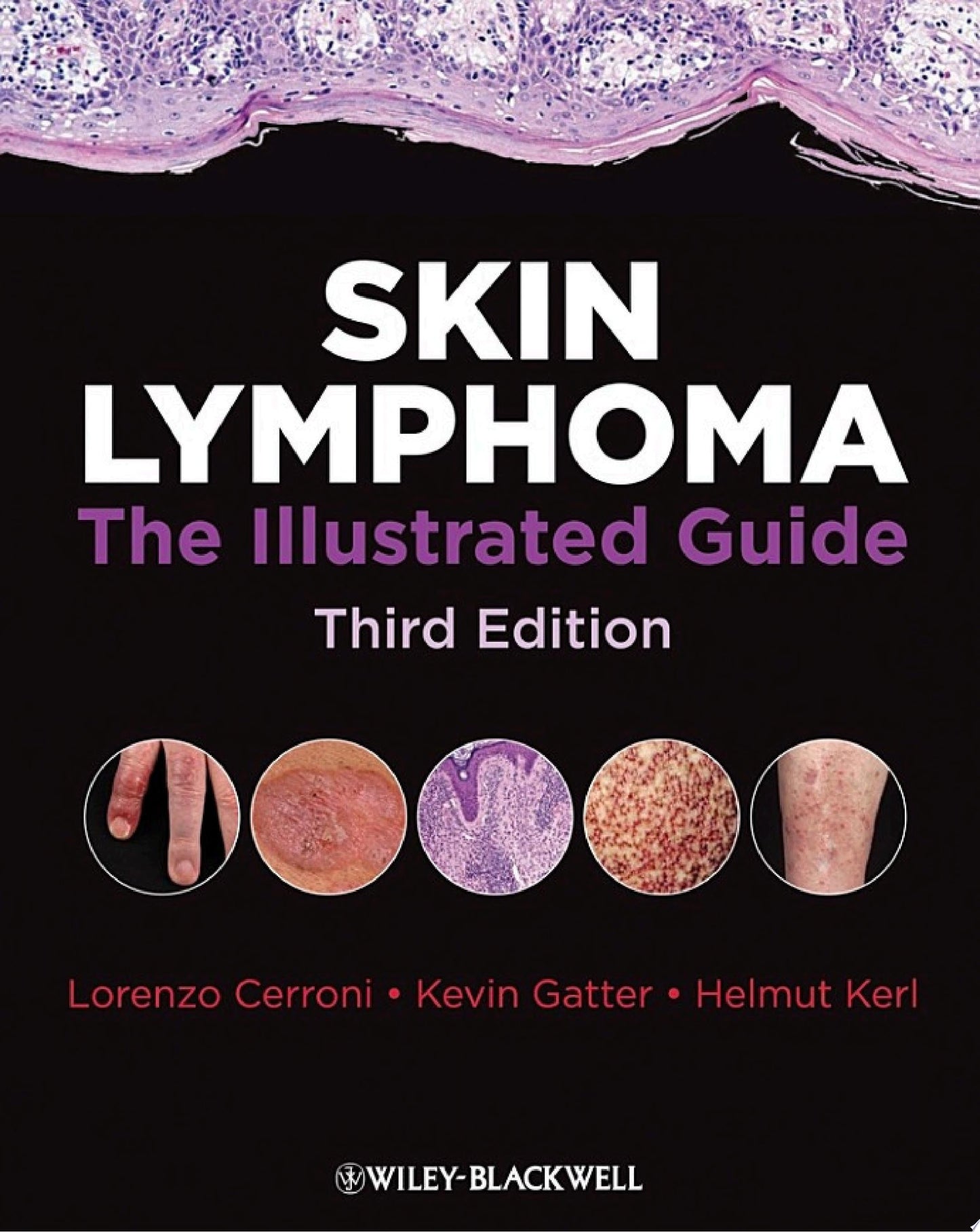 Skin Lymphoma: The Illustrated Guide, 3rd Edition
