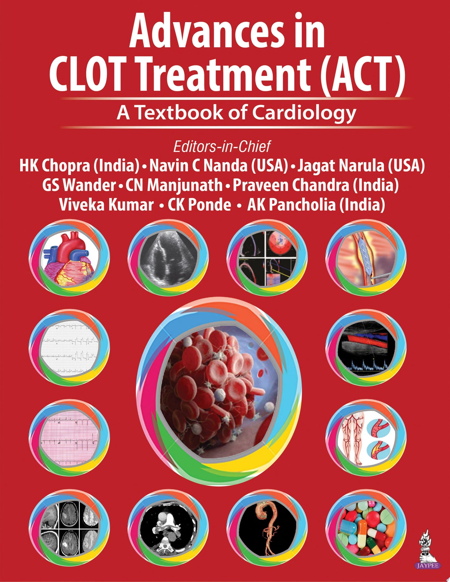 Advances in CLOT Treatment : A Textbook of Cardiology