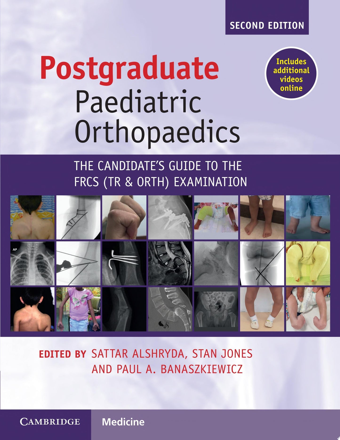 Postgraduate Paediatric Orthopaedics: The Candidate’s Guide to the FRCS (Tr and Orth) Examination (ORIGINAL PDF from Publisher)