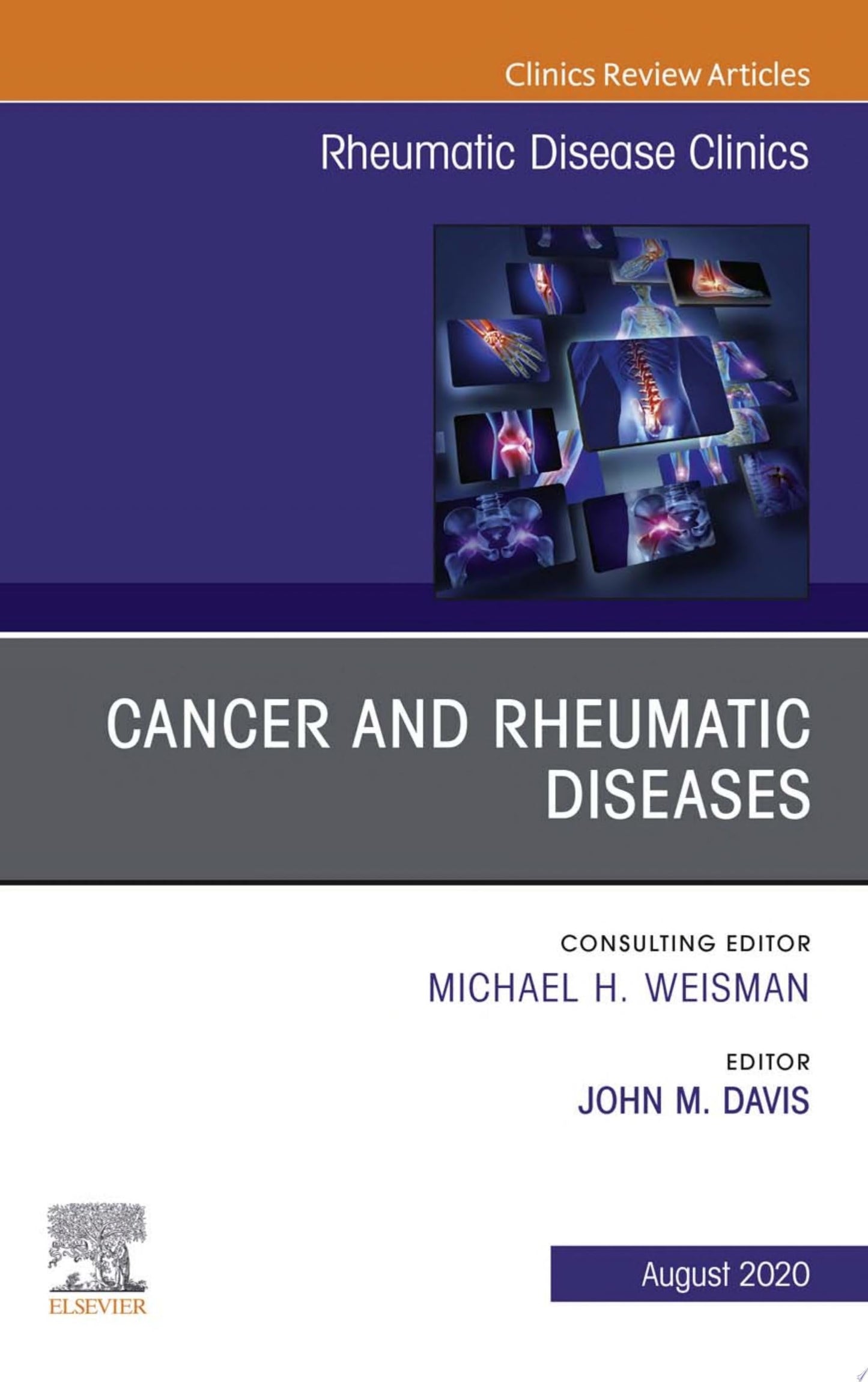 Cancer and Rheumatic Diseases, An Issue of Rheumatic Disease Clinics of North America