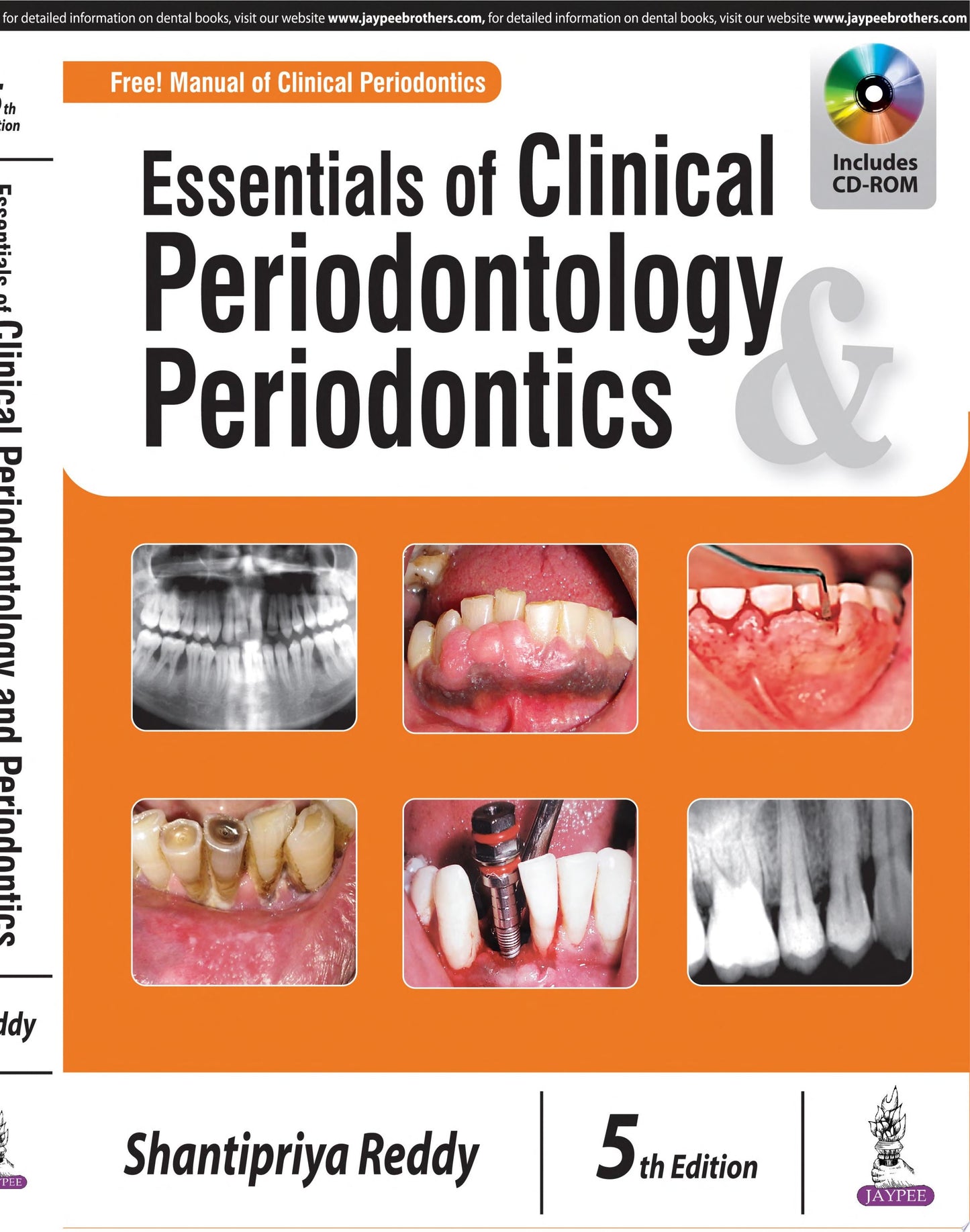 Essentials of Clinical Periodontology & Periodontics