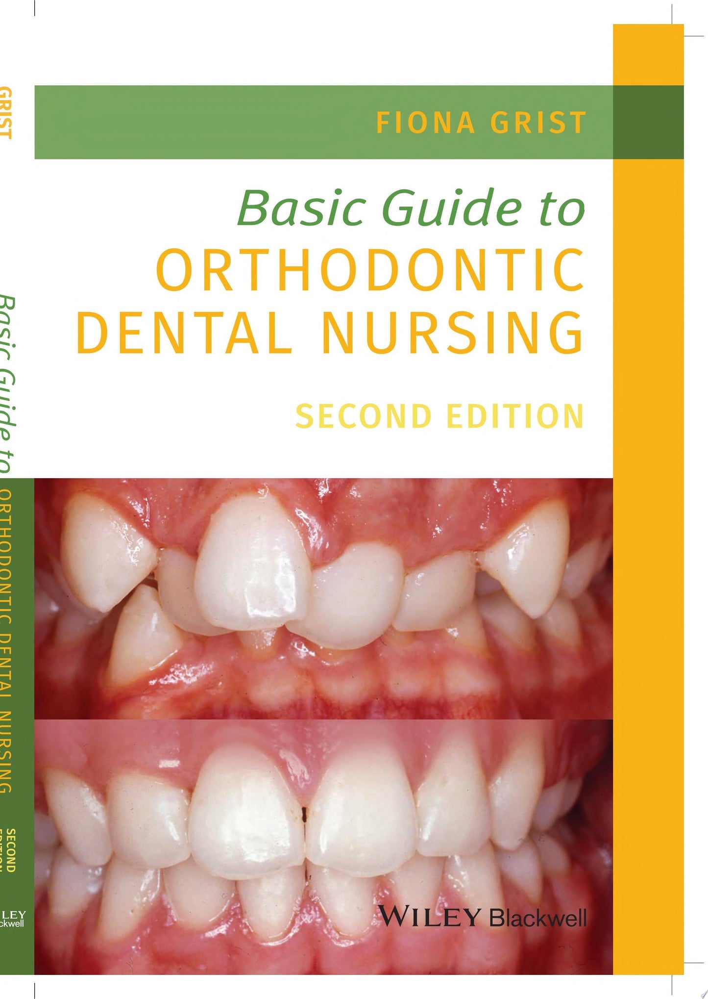 Basic Guide to Orthodontic Dental Nursing