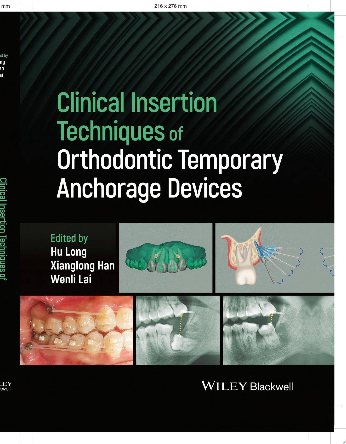 Clinical Insertion Techniques of Orthodontic Temporary Anchorage Devices