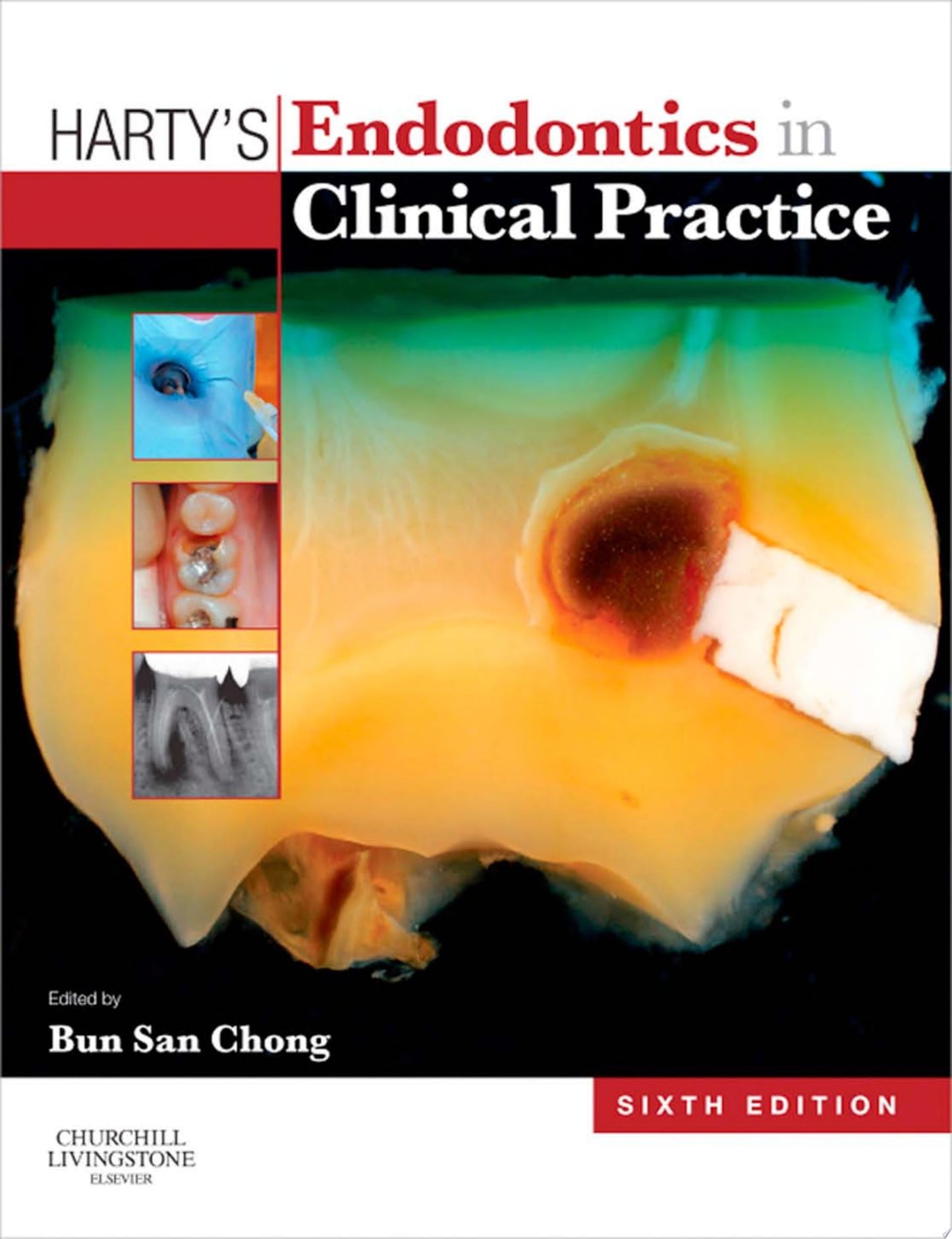 Harty's Endodontics in Clinical Practice