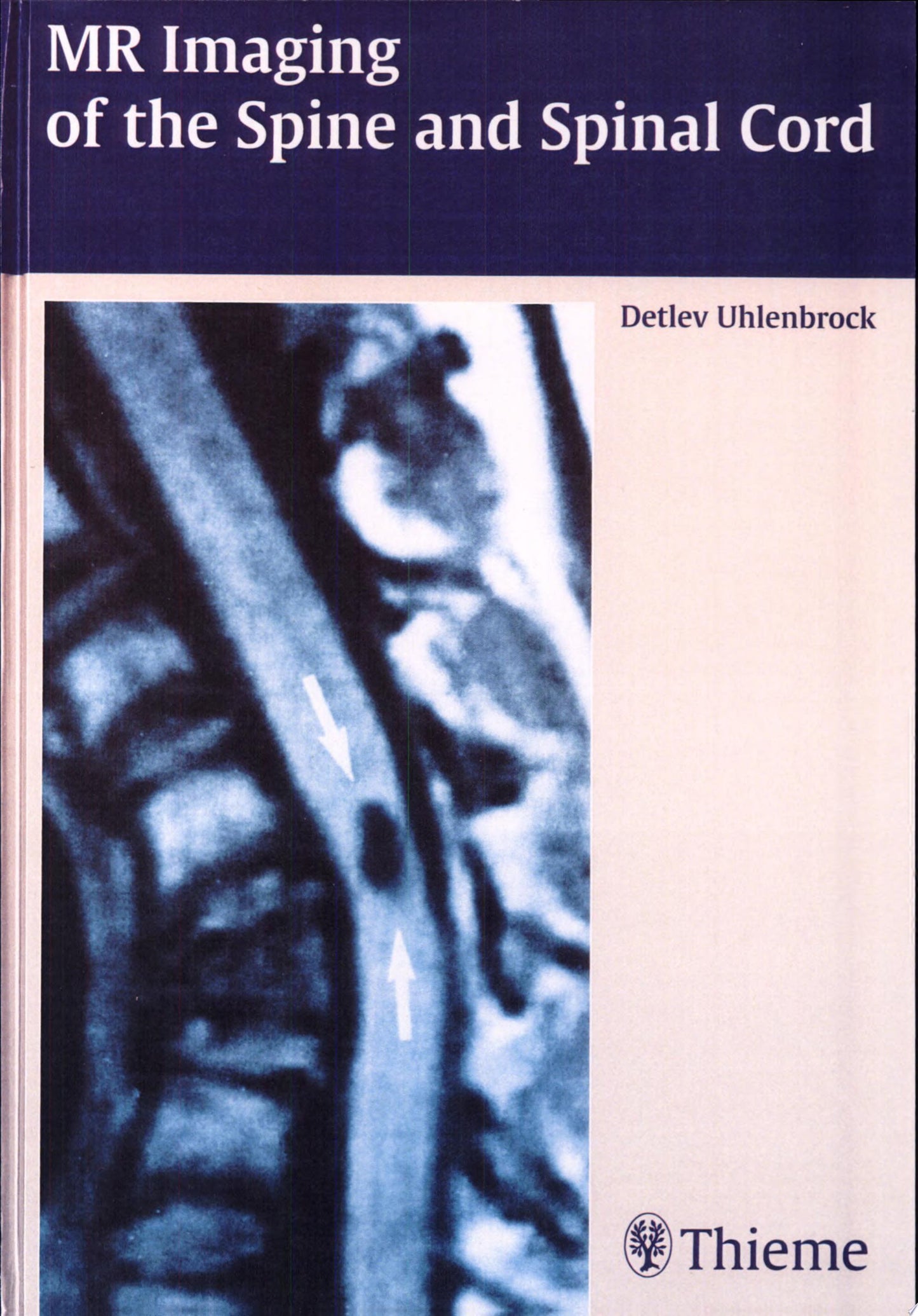 MR Imaging of the Spine and Spinal Cord