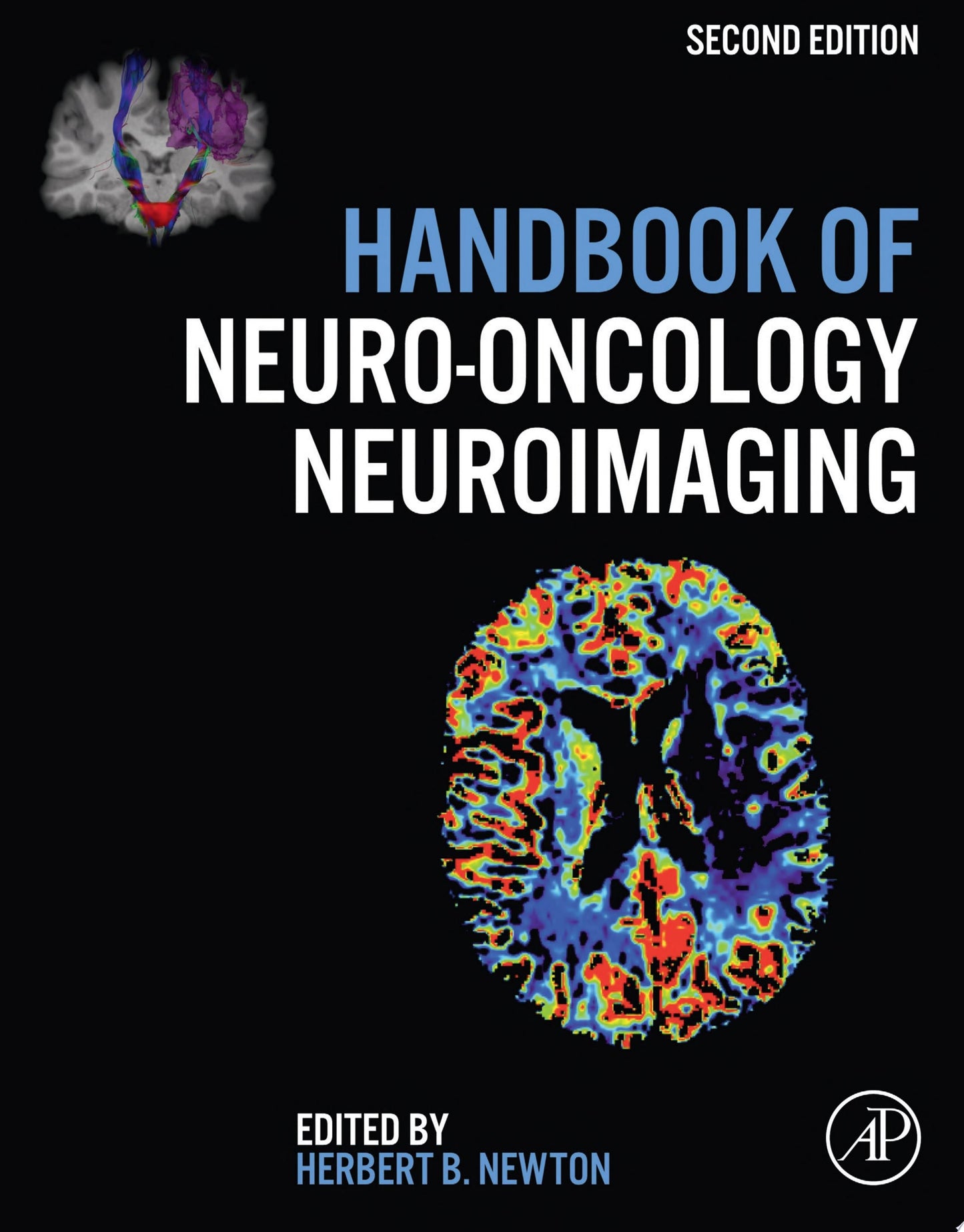 Handbook of Neuro-Oncology Neuroimaging, 2nd Edition