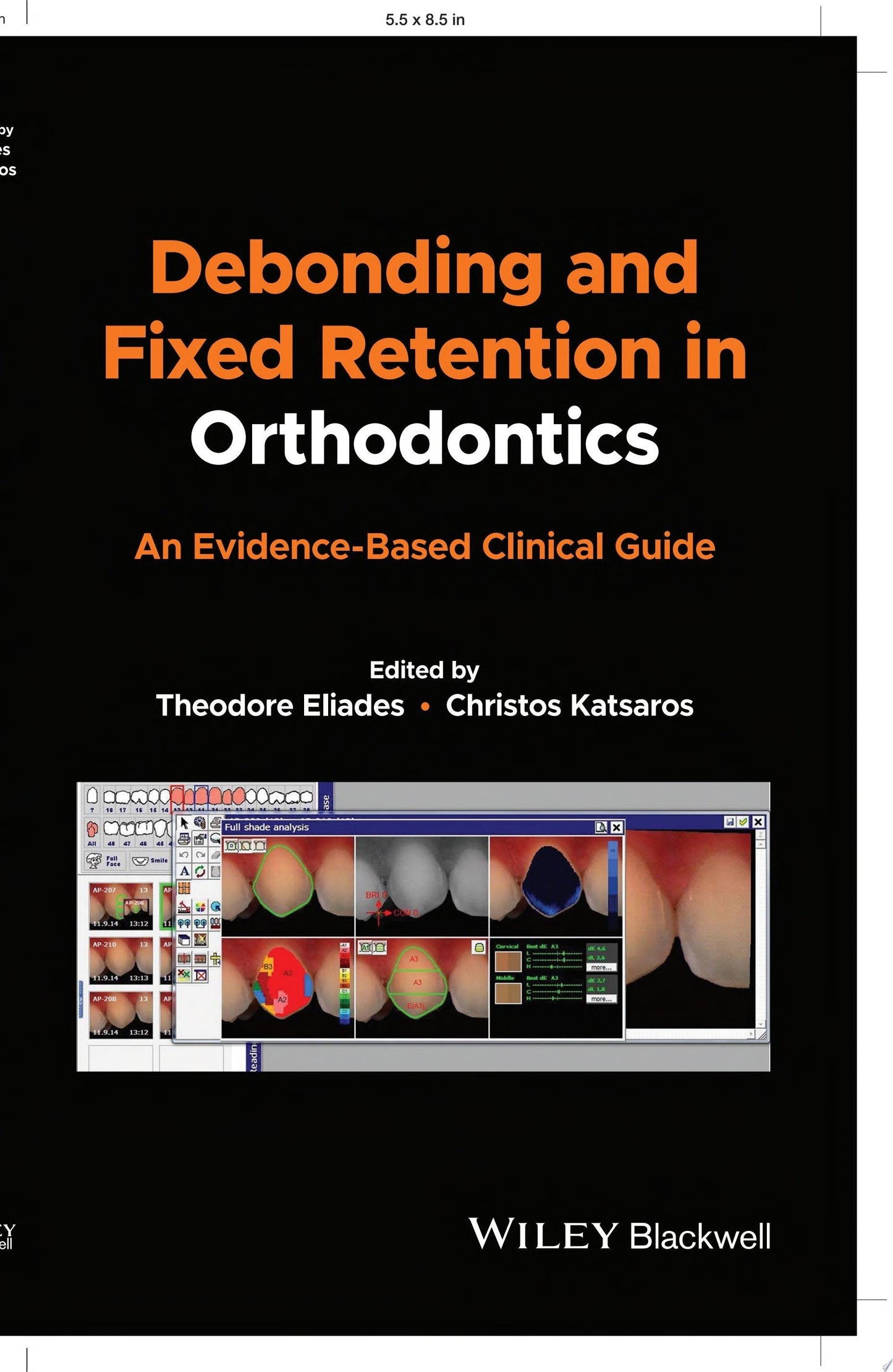Debonding and Fixed Retention in Orthodontics