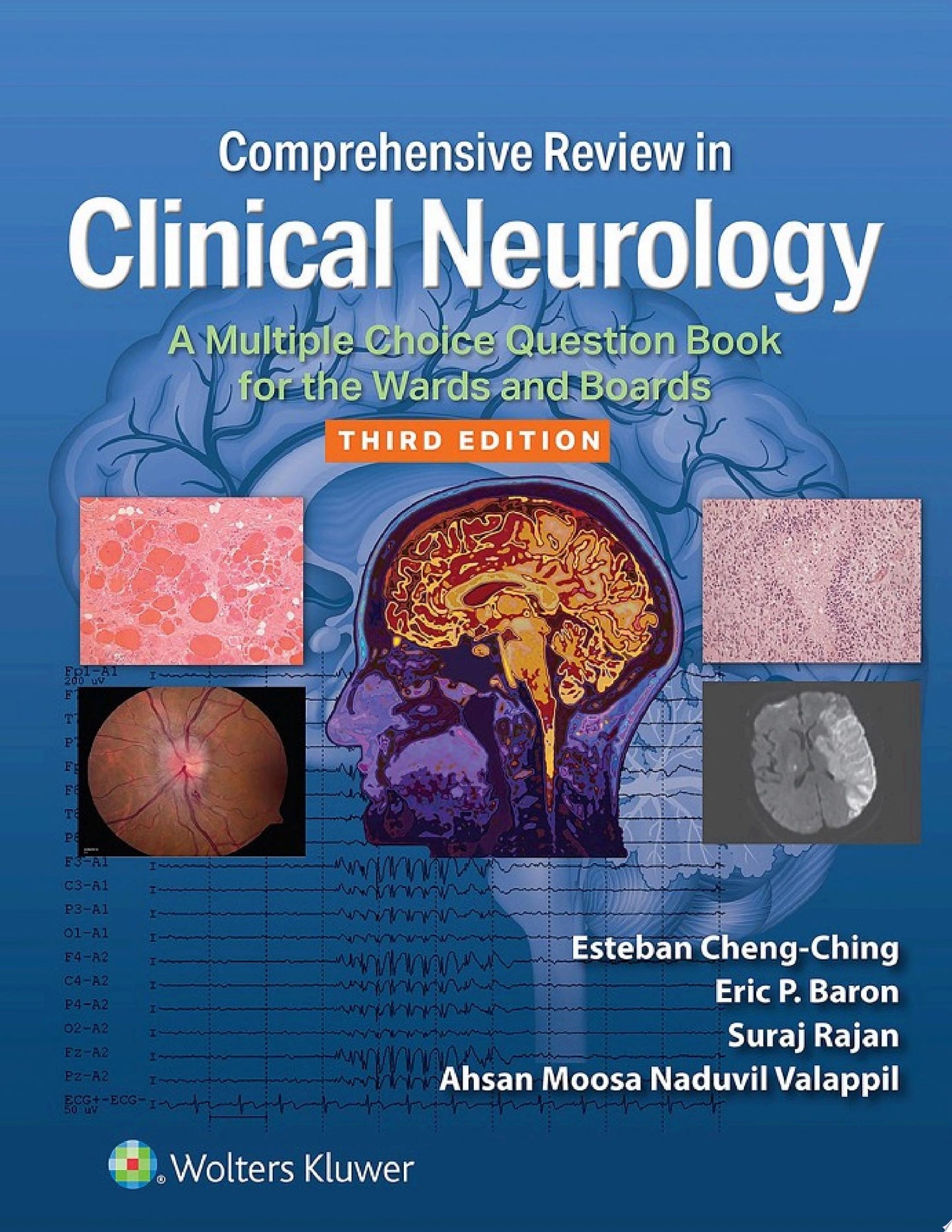 Diagnostic Pathology: Bone, 3rd edition