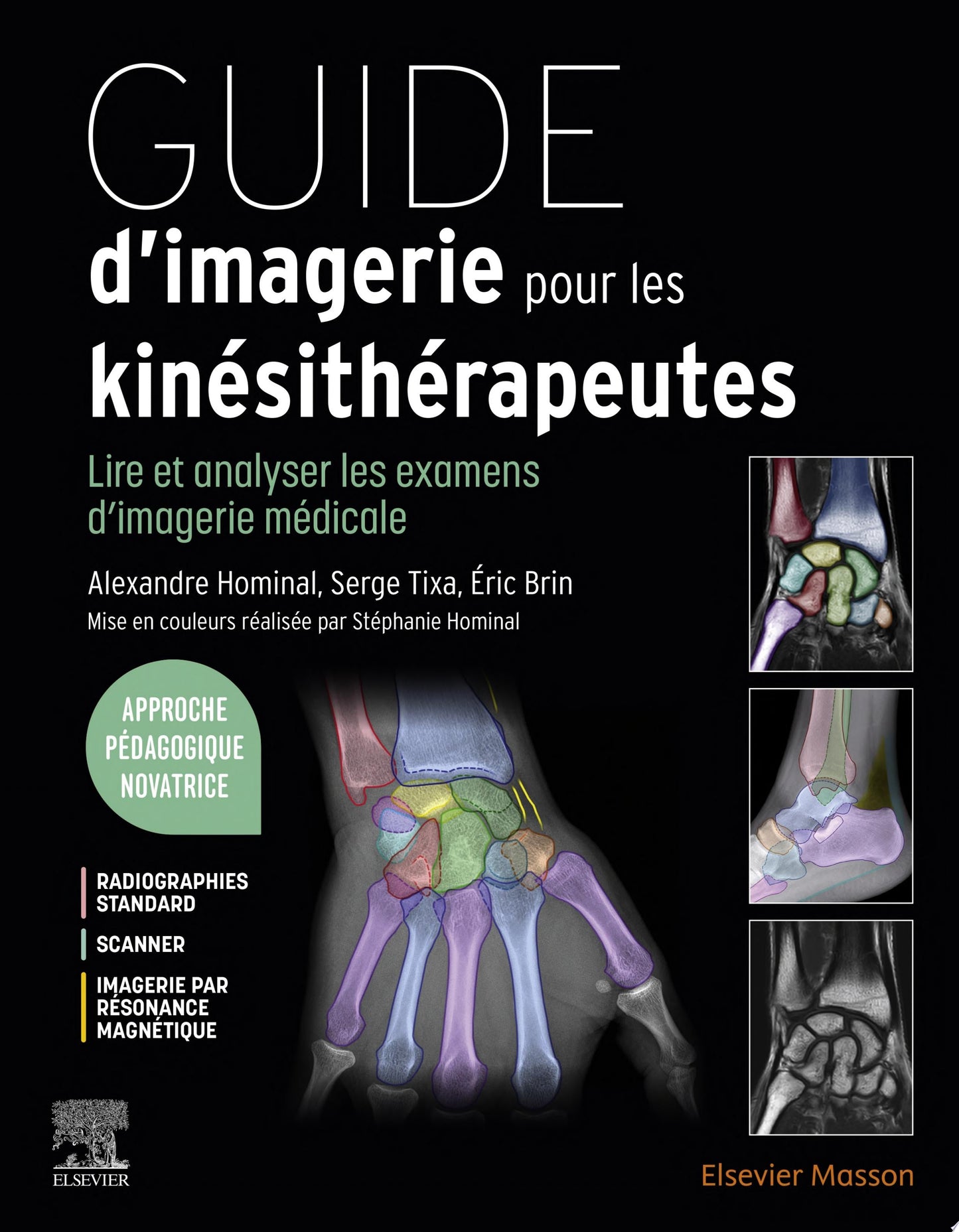 Guide d'imagerie pour les kinésithérapeutes: Lire et analyser les examens d'imagerie médicale