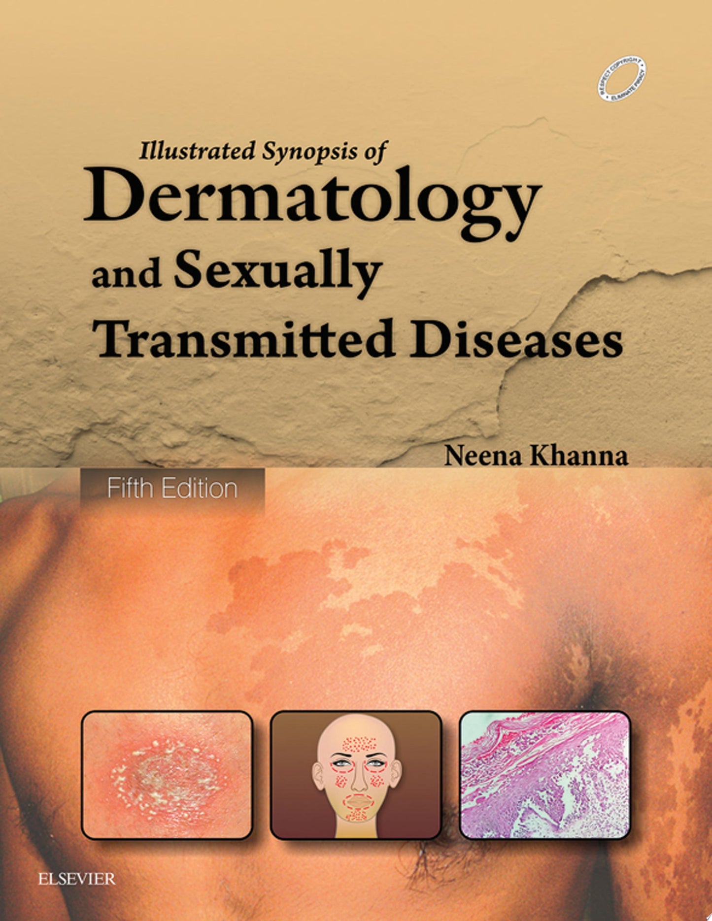 Illustrated Synopsis of Dermatology & Sexually Transmitted Diseases - E-book 5th Edition