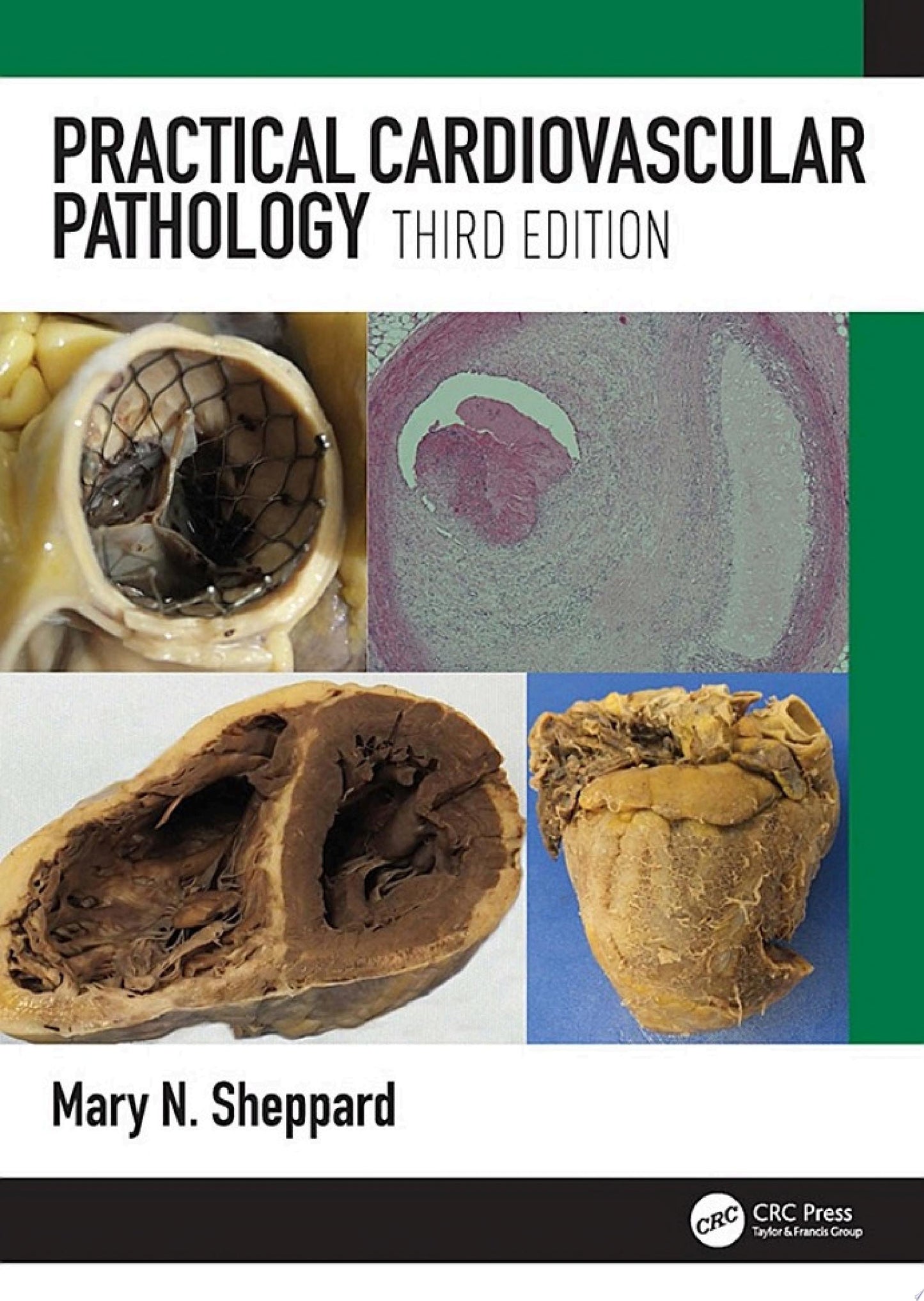 Practical Cardiovascular Pathology, 3rd Edition