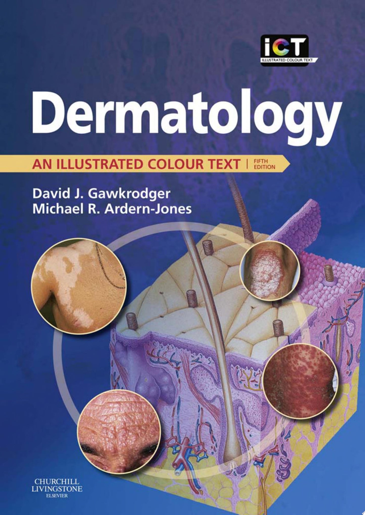 Dermatology: An Illustrated Colour Text 5e Edition