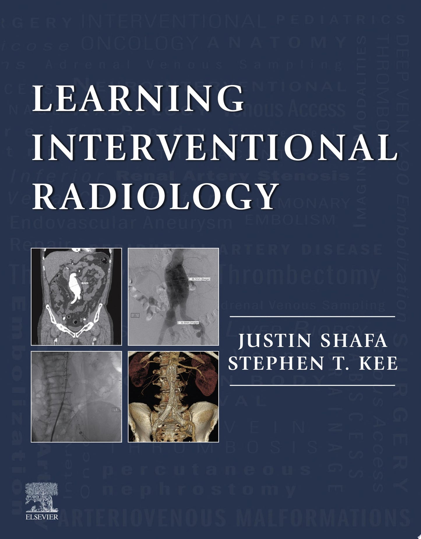 Vascular and Interventional Radiology: The Requisites, 2nd Edition