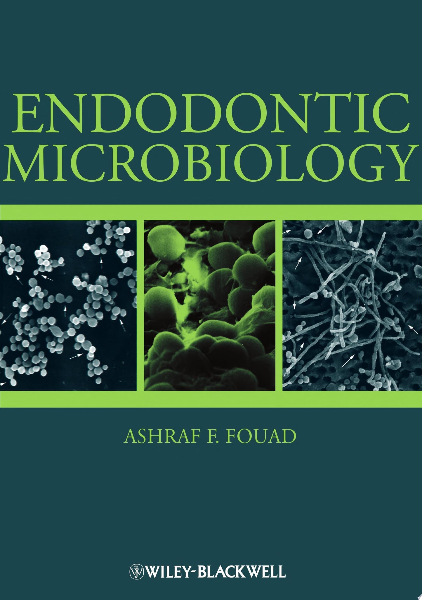 Endodontic Microbiology