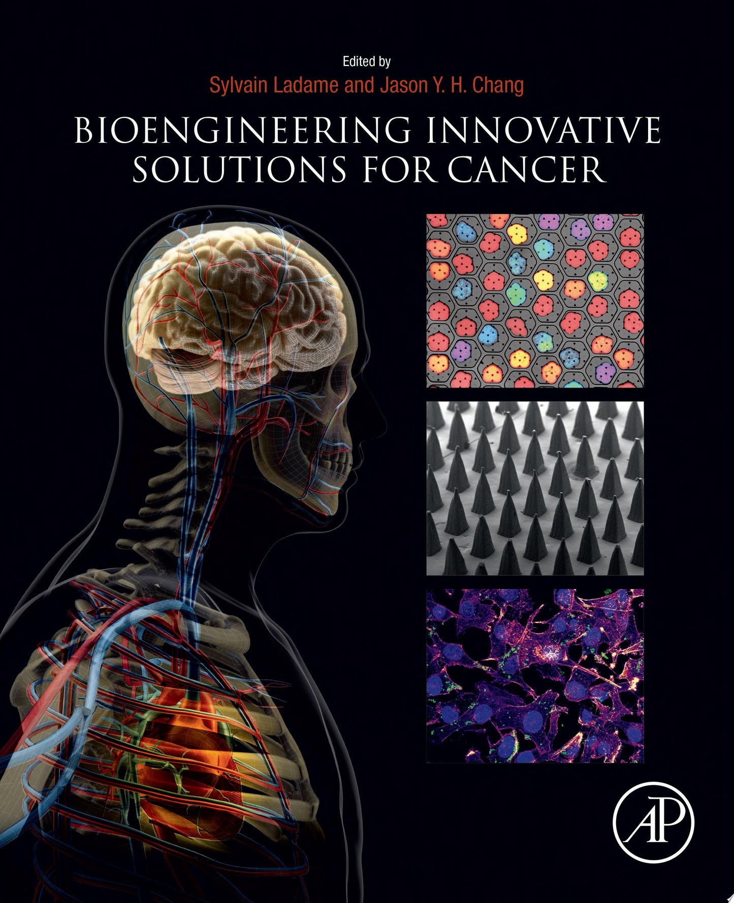 Bioengineering Innovative Solutions for Cancer