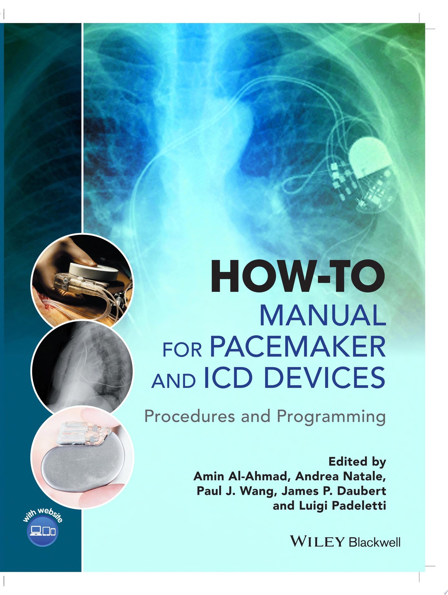 How-to Manual for Pacemaker and ICD Devices: Procedures and Programming